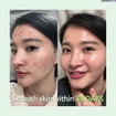 AHA-BHA-PHA 30 Days Miracle Szérum Problémás Bőrre 50ml
